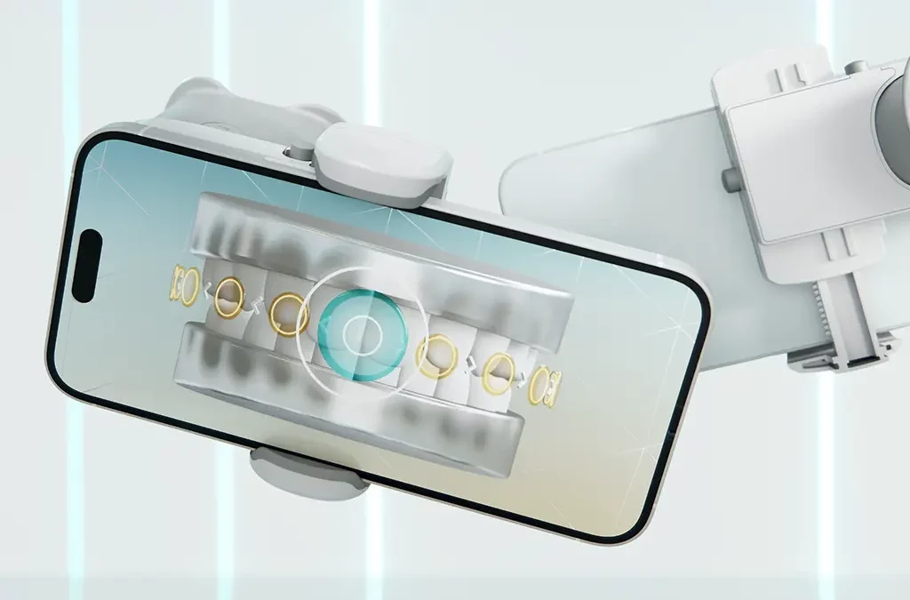 What is Dental Monitoring and How Does it Work?