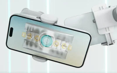 What is Dental Monitoring and How Does it Work?