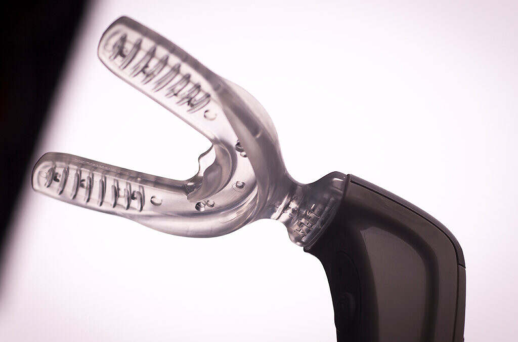 Fast-Track Your Smile: What to Know About Accelerated Orthodontics