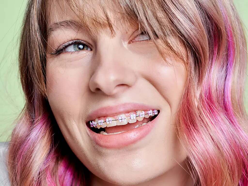 Teen smiling with purple and pink braces bands