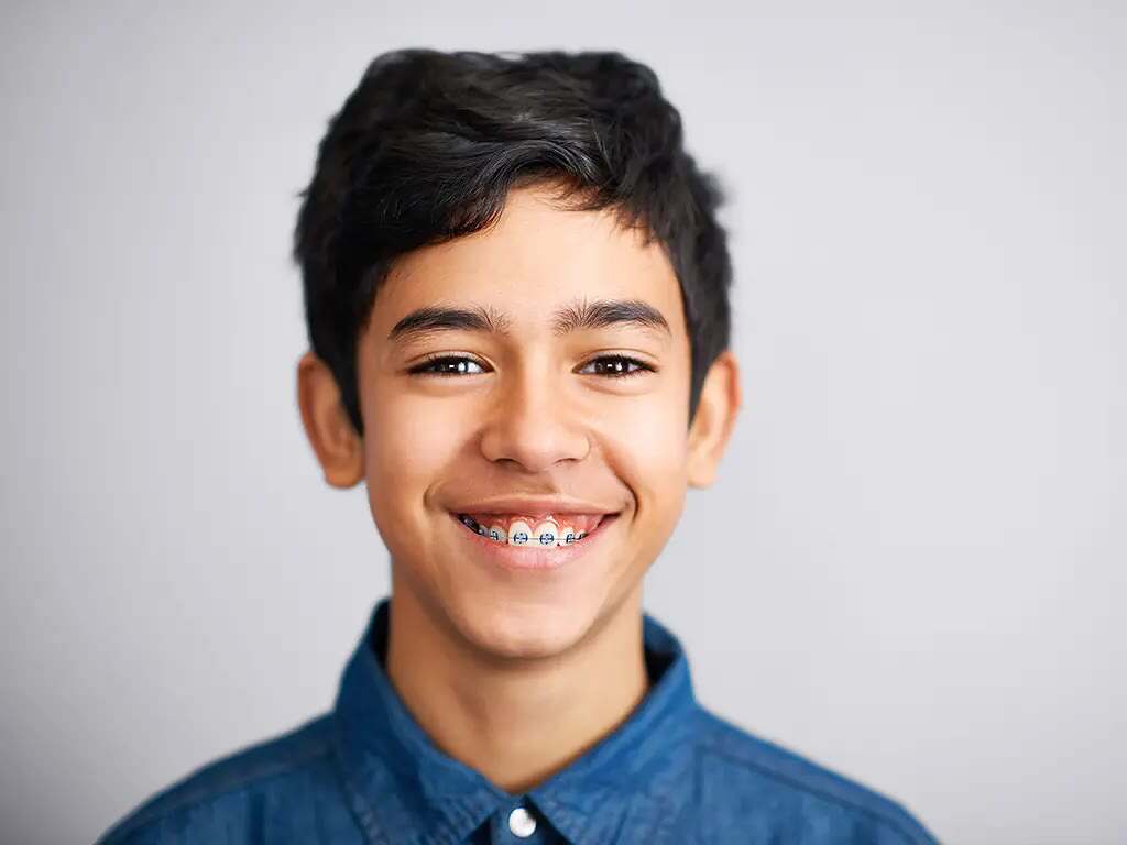Teen boy smiling with blue braces bands